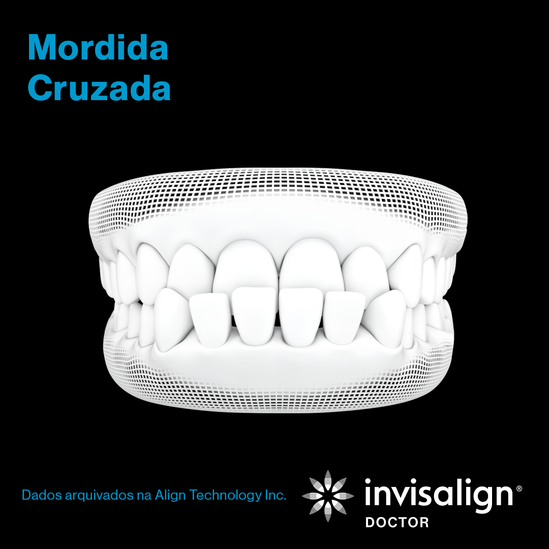 Invisalign - Dra. Gabriella Fortes